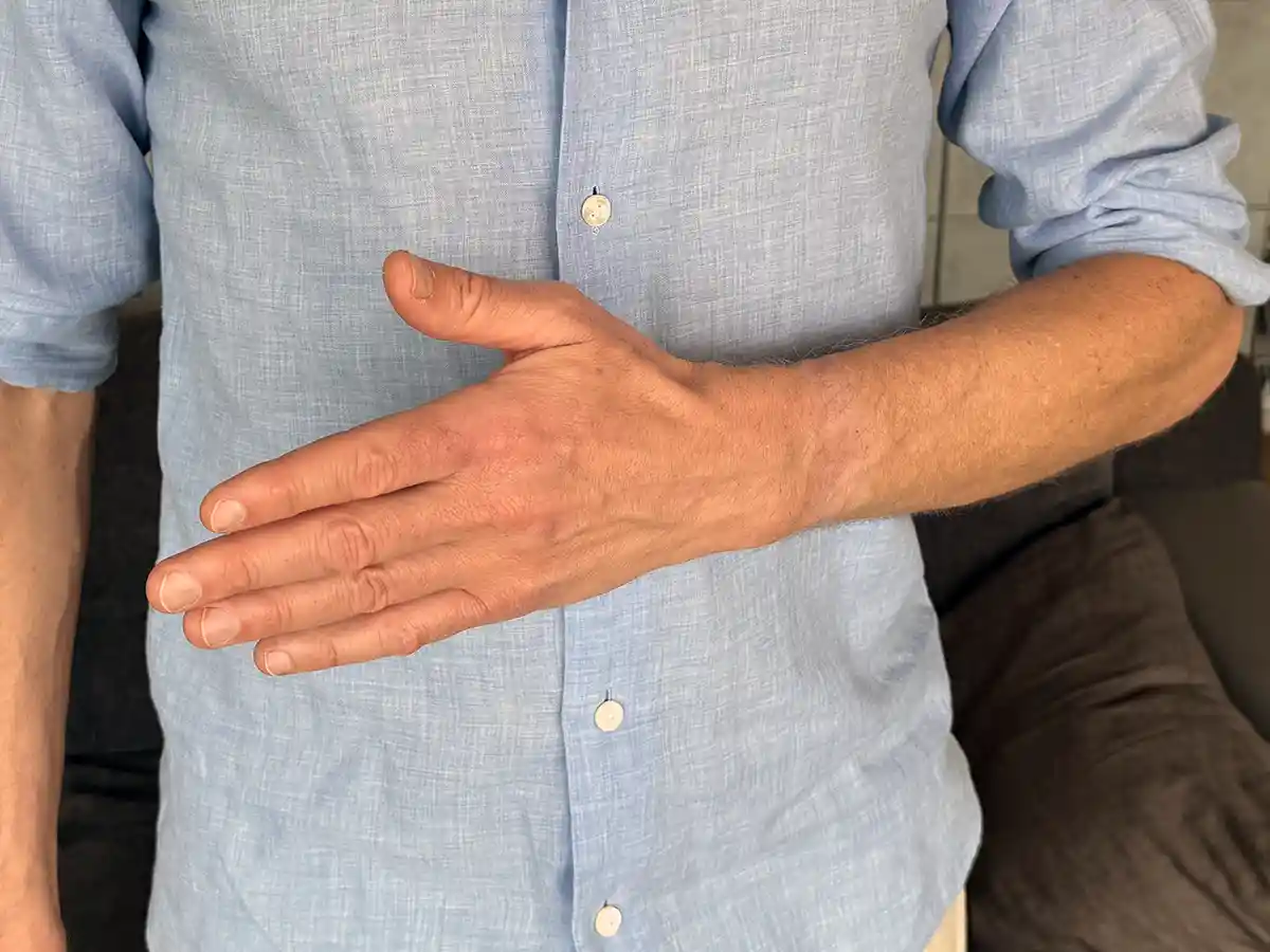 Finkelsteins test du kan göra själv hemma för att se om du lider av De Quervains syndrom. Utgångsposition.