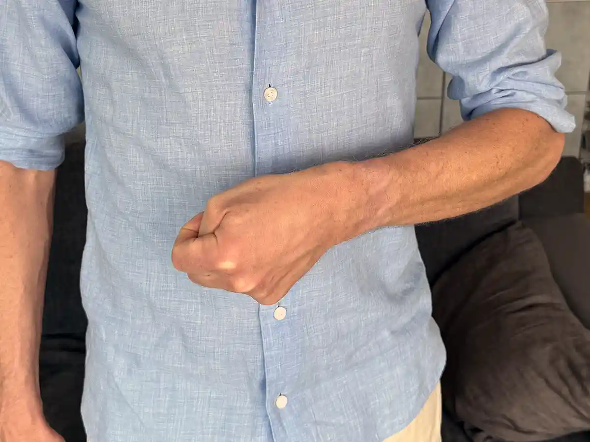 Finkelsteins självtest för att se om du lider av De Quervains syndrom. Position med tummen knuten i handen och handen böjd ner åt lillfingrets håll.