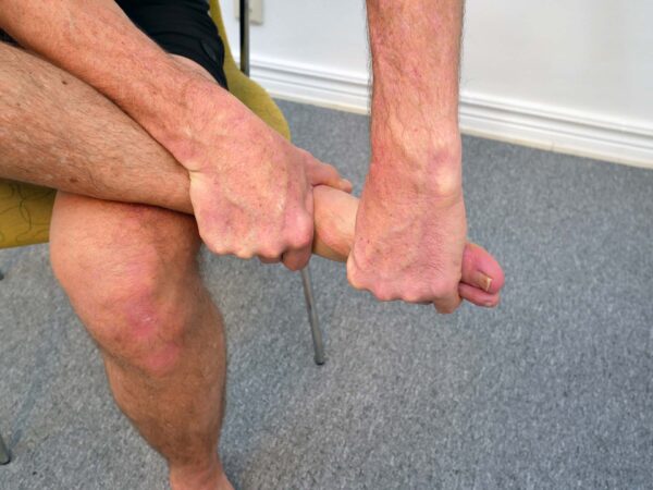 Person sitter med ena foten i knät och håller foten med båda händerna.