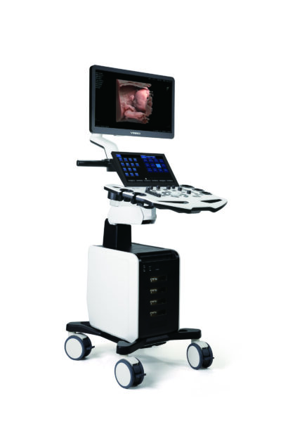 VINNO S300 stationär ultraljudsplattform - detaljvy av touchpanel och kontroller