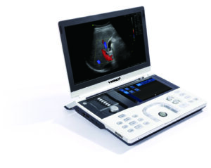 VINNO V6 - portabel ultraljud i laptop-format för MSK-diagnostik